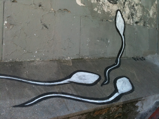 Illustration for article titled How can a small piece of copper prevent you from getting pregnant?